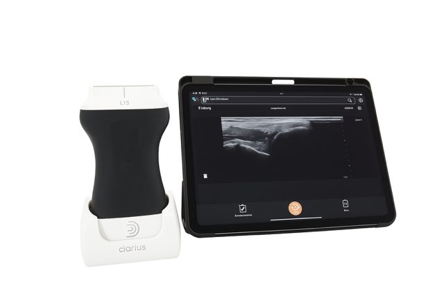 Clarius L15 draadloze echokop met tablet die een echobeeld toont, gebruikt voor diagnostiek van peesblessures in de fysiotherapie