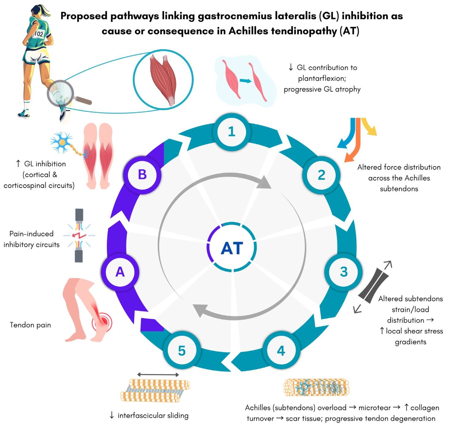 schematische weergave hoe achillespeesklachten kunnen ontstaan